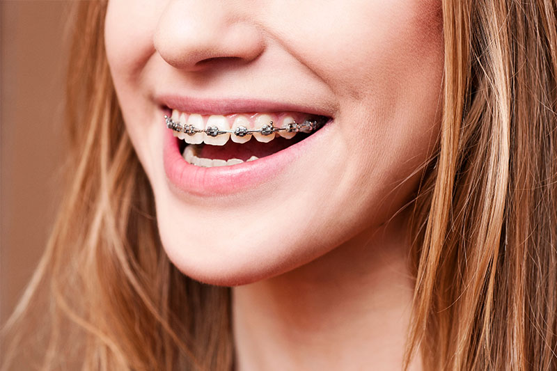 Orthodontics in Skokie, Chicagoland